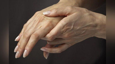 '​«Қўлда ҳам варикоз бўладими?»'ning rasmi