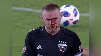 'Runi Amerika ligasidagi birinchi matchida burnini sindirib oldi (Video)'ning rasmi