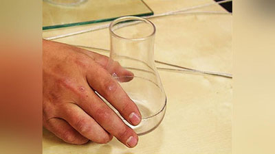 'Toshkentda ayolning yuziga kislota sepib yuborgan shaxslar qo`lga olindi'ning rasmi