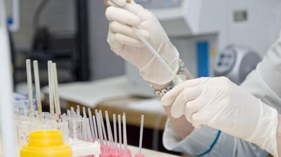 Изрображение 'В Словакии после вакцинации препаратом AstraZeneca умерла женщина'