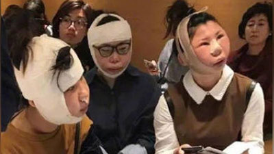 Изрображение 'КИТАЯНОК НЕ ПУСТИЛИ НА РОДИНУ ИЗ-ЗА РАСПУХШИХ ПОСЛЕ ПЛАСТИКИ ЛИЦ'