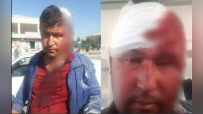 '"Shahrisabzda fuqaro "ko`cha bolalari" tomonidan vahshiylarcha kaltaklandi" deyilgan xabarga izoh berildi'ning rasmi