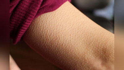 'Evolyusiya davomida keraksiz bo`lib qolgan inson mushak tolasi 'ning rasmi