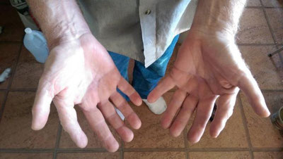 'Инсондаги ортиқча бармоқ, хол, қулоқнинг ортиғини кесиб ташлашнинг ҳукми қандай?'ning rasmi