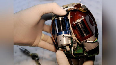 Изрображение 'Скончался обладатель самого долговечного пересаженного сердца'