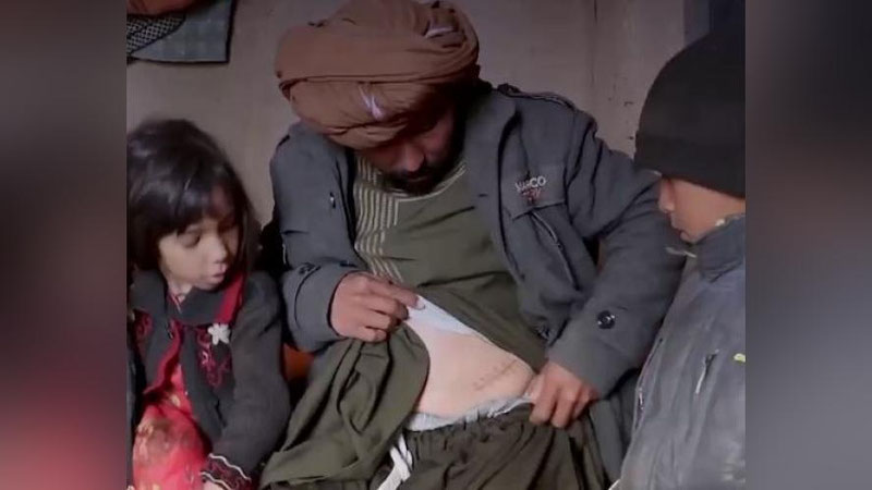 Изрображение 'Жители Афганистана вынуждены продавать почки, чтобы выжить (видео)'