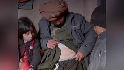 Изрображение 'Жители Афганистана вынуждены продавать почки, чтобы выжить (видео)'