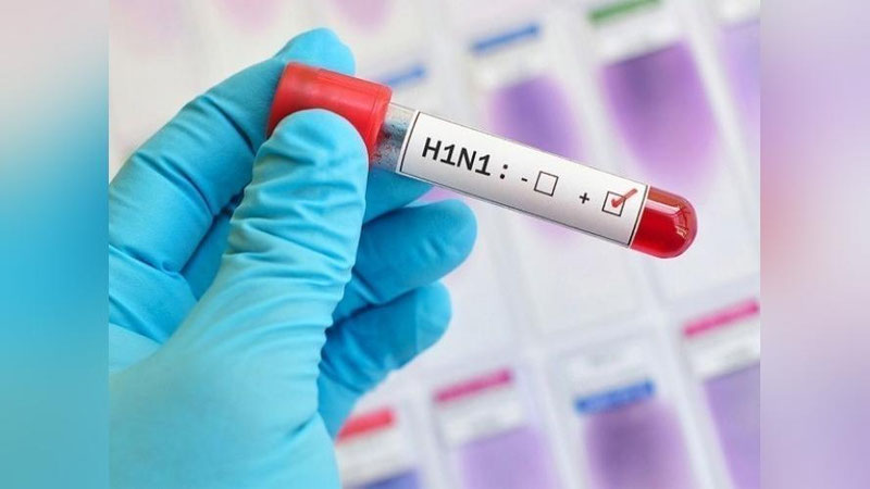 '5 nafar o`zbekistonlik sportchida taqiqlangan modda borligi aniqlangan'ning rasmi