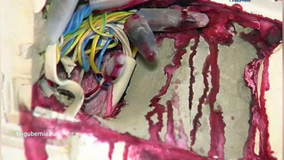 '​Voronejlik ayolning uyida rozetkadan “qon oqmoqda” (Video)'ning rasmi