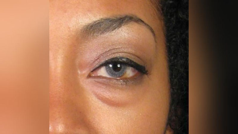 'Madad-shifo: KO`Z OSTIDA HALQA PAYDO BO`LSA...'ning rasmi