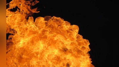 'Qarshida gaz chaqnashi oqibatida 5 yoshli qizcha kuyish jarohatini oldi'ning rasmi