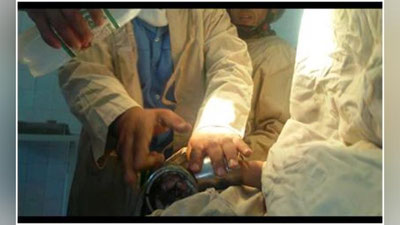 '​Самарқандлик қутқарувчилар гўштқиймалагич ичидан 4 ёшли боланинг қўлини чиқариб олишди(Фото)'ning rasmi