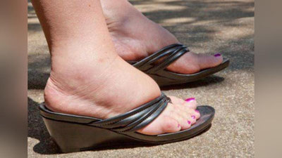 '​Оёқдаги шишларни қандай кетказиш мумкин?'ning rasmi