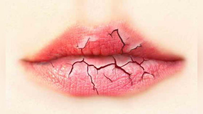 'Madad-shifo: LABINGIZ TEZ-TEZ YoRILSA...'ning rasmi