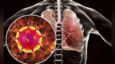 'Ӯzbekistonda koronavirus bilan kasallangan odam aniqlandi. Bemor Fransiyadan kelgan'ning rasmi