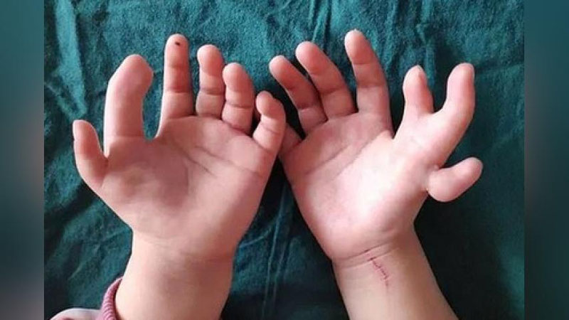 Turk porno Porno Belle multfilm