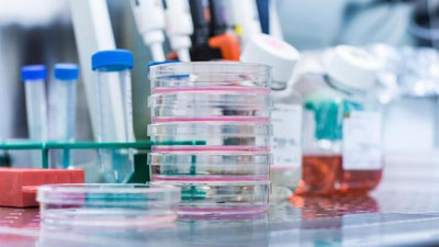 'Germaniyada koronavirusni aniqlovchi dunyodagi eng tezkor test tizimi yaratildi'ning rasmi