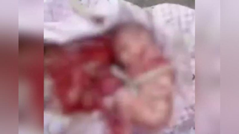 'Xorazmdagi chiqindixonada chaqaloq topildi. Afsuski, u...'ning rasmi