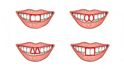 'Oldi tishlarda odamlarning fe`l-atvorini aniqlab beradi'ning rasmi