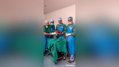 'Hindistonlik shifokorlar bemordan 7, 4 kilogramm gigant buyrakni olib tashlashdi'ning rasmi