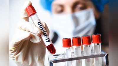 'Dunyoda koronavirus bilan kasallanish holati 41 milliondan oshdi'ning rasmi