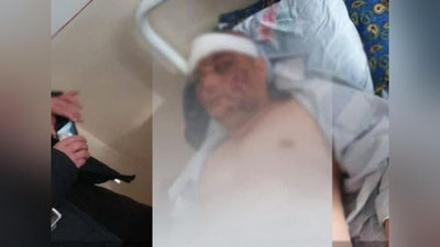 Изрображение 'По факту жестокого избиения жителя Яккабага заведено уголовное дело'