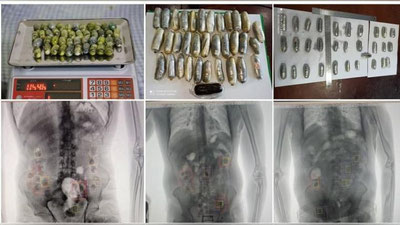 '"Ayritom" chegara-bojxona postida giyohvandlik vositalarini ichki a`zolariga yashirib, O`zbekistonga kirib kelayotgan xorij fuqarolari qo`lga olindi'ning rasmi