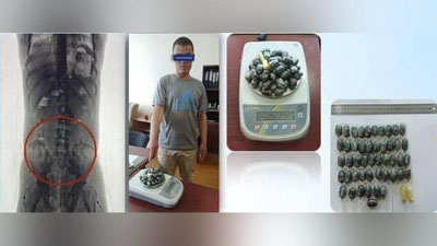 'Surxondaryoda chegaradan kirib kelayotgan fuqaroning organizmidan 47 dona skotchlangan o`ramdagi giyohvandlik moddasi chiqarib olindi'ning rasmi