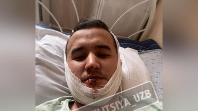 'Toshkentda fuqaro hech bir sababsiz ommaviy kaltaklandi (video)'ning rasmi