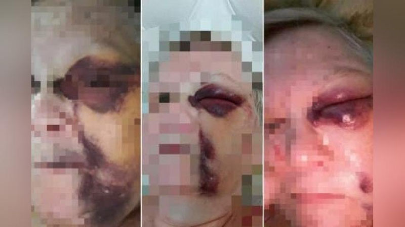 'Toshkentda 63 yoshli ayolga nevarasi tengi yigitning shilqimlik qilgani bo`yicha rasmiy bayonot berildi'ning rasmi