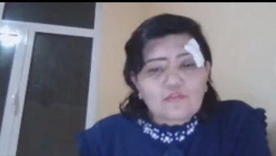 'Блогер Фотима Жўраевага суиқасд қилиндими? Бош прокуратура маълумот берди'ning rasmi