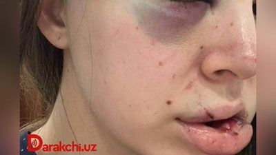 'Toshkenda erkak xotinini ayovsiz kaltaklab, erto`lada saqlab kelgani ma`lum qilindi'ning rasmi