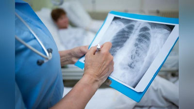 'Ўзбекистон тиббиёти туберкулёзга қанча муддатда аниқ ташхис қўяолади?'ning rasmi