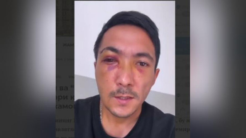 'Kaltaklab ketilgan bloger shifoxonadan ko`rinish berdi (video)'ning rasmi