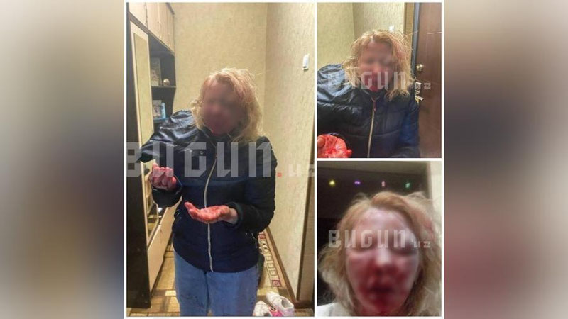 'Toshkentda mast erkak onasining boquvchisini ayovsiz kaltakladi (video)'ning rasmi