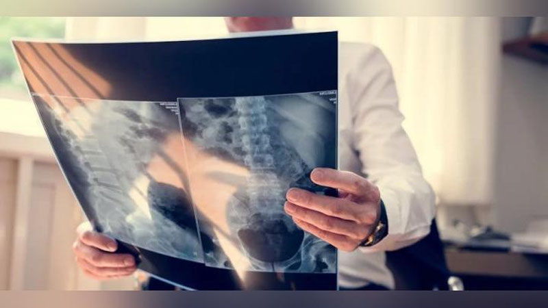 'Qirq yoshdan keyin nega suyak emirilishi kuchayadi?'ning rasmi