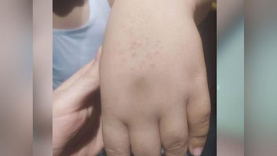 'Maktabda o`quvchilarning qo`liga igna va "samorez" sanchib jazolash holatini Ombudsman nazoratga oldi'ning rasmi