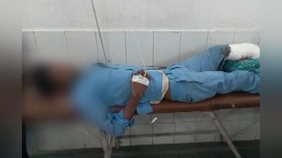 'Ҳиндистонлик эркак кесилган оёғини ёстиқ қилди (Видео)'ning rasmi