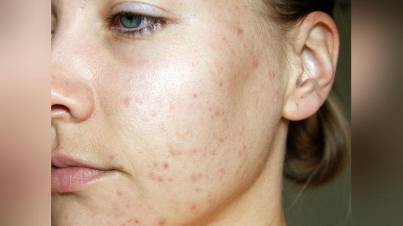 '«KOSMETOLOGGA BORIShDAN QO`RQAMAN…»'ning rasmi