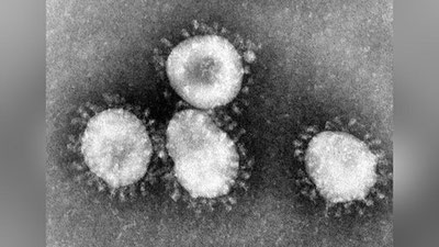 'Koronavirus O`zbekistonga 15 martdan oldin kirib kelgan bo`lishi ham mumkin'ning rasmi