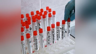 'O`zbekistonda koronavirus infeksiyasi qayd etilganlar soni 103 nafarga ko`paydi'ning rasmi