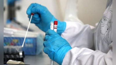 'Коронавирус: кеча юртимизда 230 нафардан зиёд кишида касаллик аниқланиб, яна 2 нафар бемор вафот этди'ning rasmi