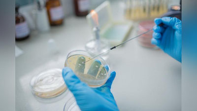 'Сайёҳлар “Сибир куйдиргиси” хавфидан огоҳлантирилди'ning rasmi