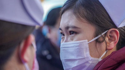 'COVID bilan kasallanganlar bir muncha vaqt o`tgandan so`ng sochlari ko`p to`kilayotganiga shikoyat qilishyapti'ning rasmi