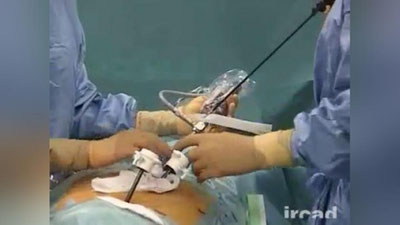 '“SINGLIMGA QO`YILGAN TAShXISDAN XAVOTIRDAMAN!?”'ning rasmi