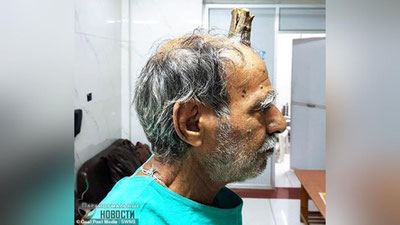 'Hindistonlik qariyaning shoxi kesib tashlandi'ning rasmi