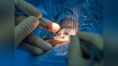 '​Eron sudi ayolning bir ko`zini ko`r qilishga hukm chiqardi'ning rasmi