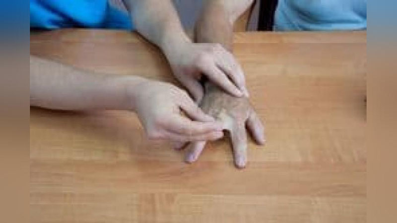 'Falajlangan qo`llar funksiyasini tiklash texnologiyasi yaratildi'ning rasmi