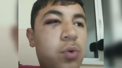 '“Ustoz hammani oldida to`g`ri ish qilmadingiz” (video)'ning rasmi