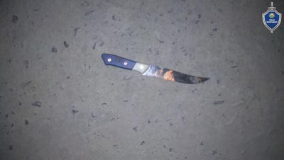 Изрображение 'В Андижанской области 18-летний парень получил тяжелое ранение в живот'